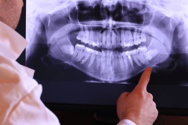 Best Emergency Dental Extractions in Rome, IL