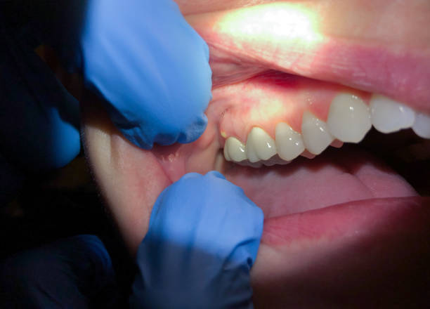 Best Emergency Cosmetic Dentistry in Rome, IL